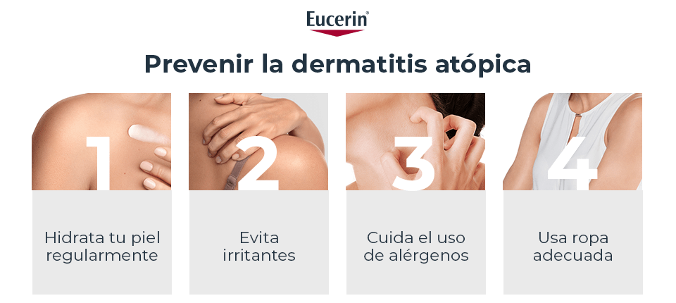 Prevención de la dermatitis atópica