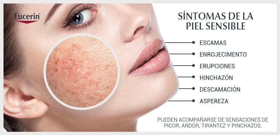 Mujer con la piel del rostro sensible