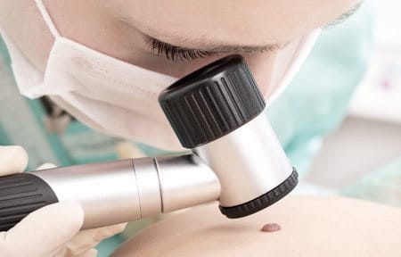 consultas regulares ao dermatologista