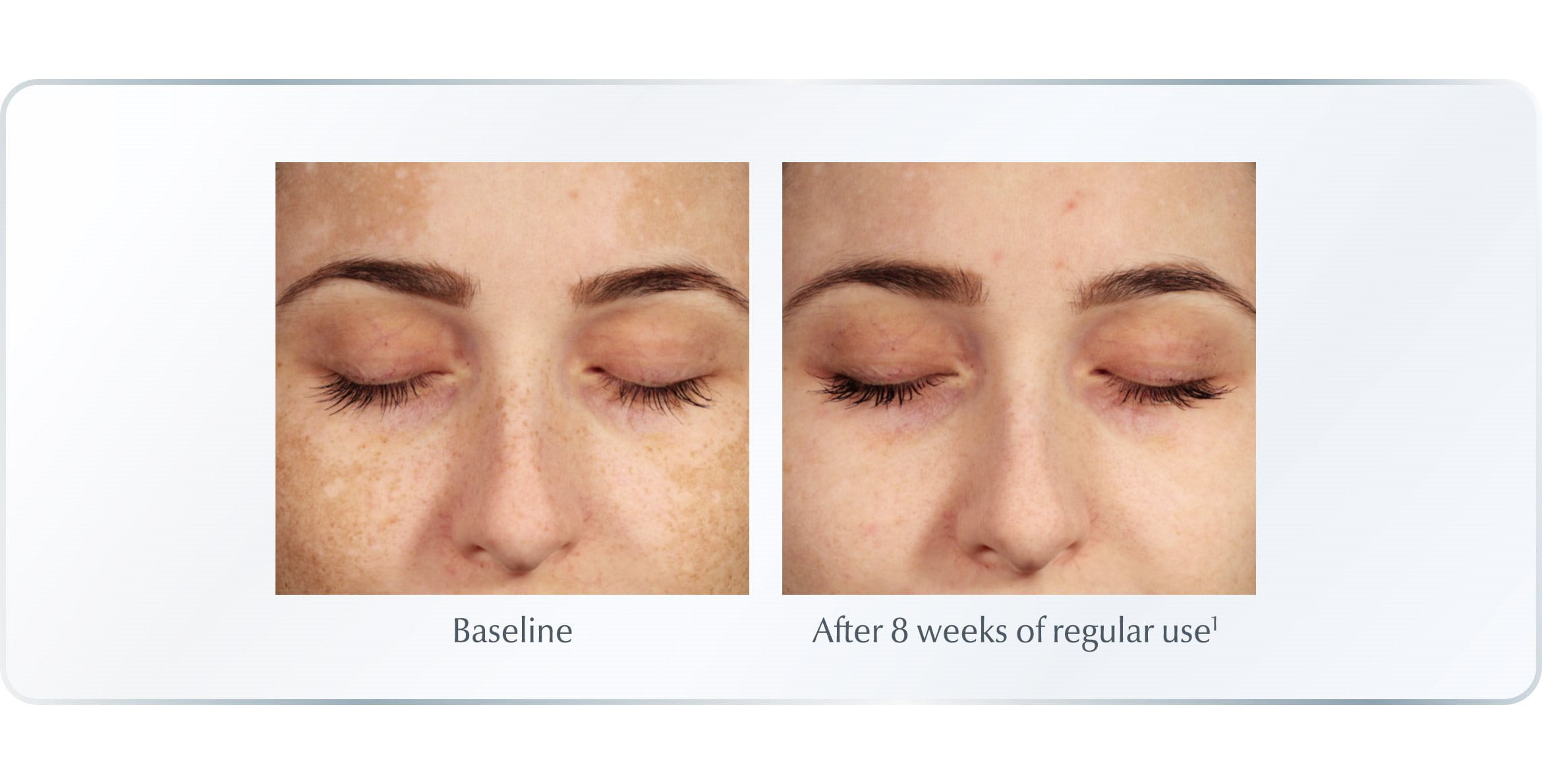 Eucerin Anti-Pigment riduce iperperpigmentazione