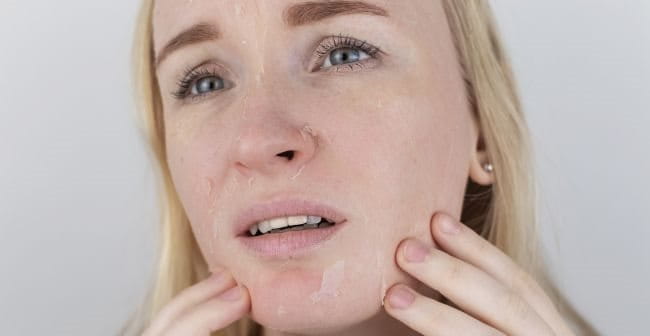 Các nhân tố bên trong khiến da khô sần sùi